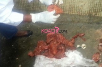 Gabon: Découverte dÂ’un sac d'organes humains à  Oloumi